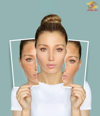 Skin Whitening Facial